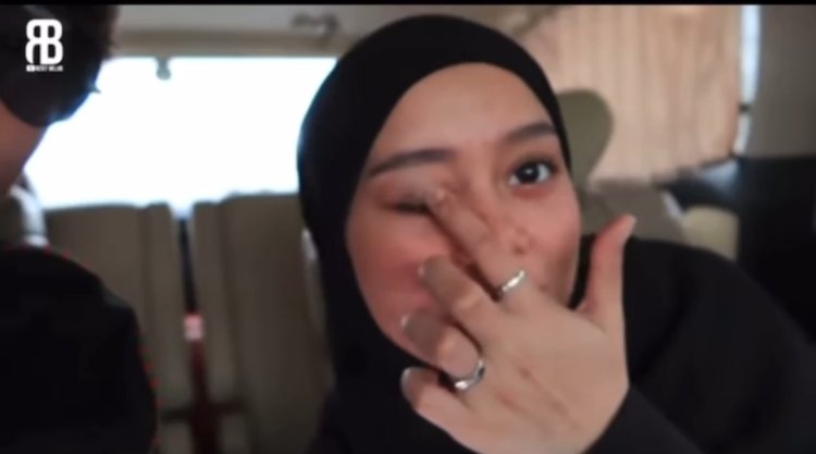 Momen Lesti Kejora Tunjukkan Mata Lebam Kembali Ramai Dikomentari Netizen