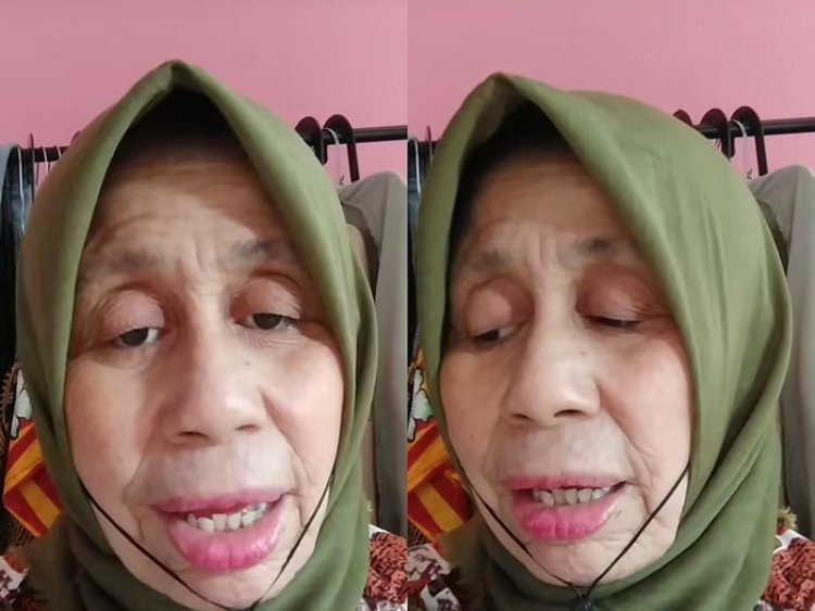 Alami Penyakit Langka, Wanita Asal Bogor Terlihat Tua Padahal Berusia 28 Tahun