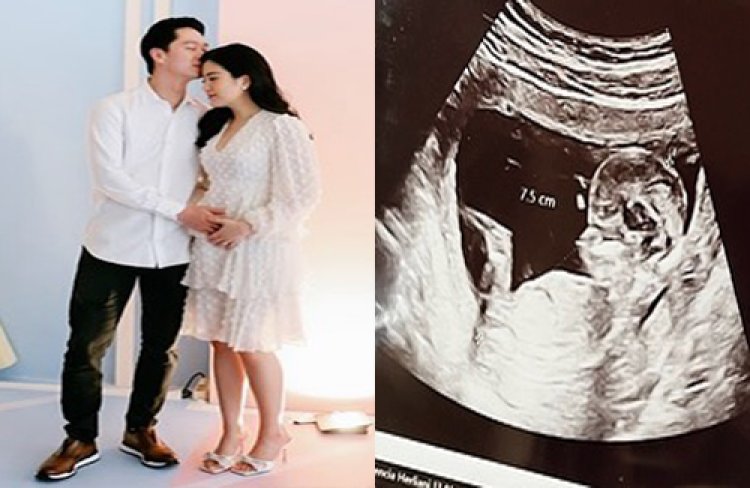 Kebahagiaan Kevin Sanjaya dan Valencia Tanoesoedibjo, Umumkan Kehamilan Anak Pertama