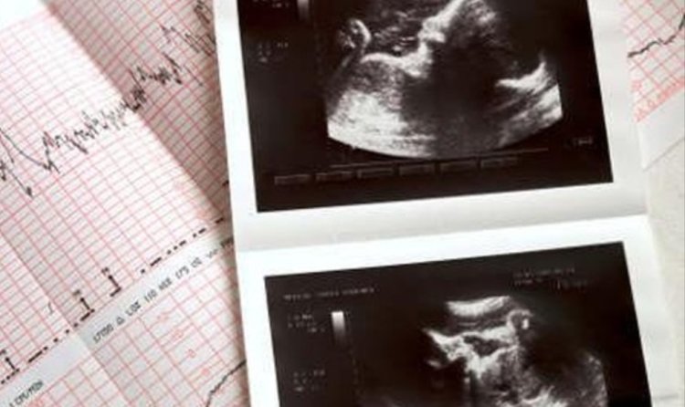 Dokter Umum Tak Boleh Cek Jenis Kelamin Bayi di Puskesmas, Menkes: Kok Ga Boleh kenapa?