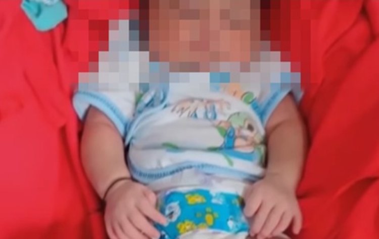 Heboh! Seorang Bayi Lahir dengan 24 Jari di Sampang