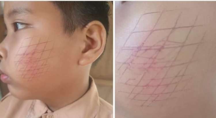 Viral Bocah Aniaya Temannya Pakai Raket Nyamuk, Ibu Korban: Ya Allah Nak