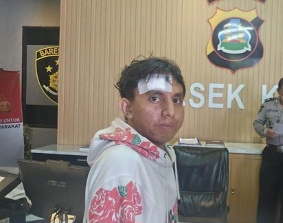 Niat Cari Kerja di Bali, Pria Asal Sumba Malah Diduga Disekap 2 Wanita