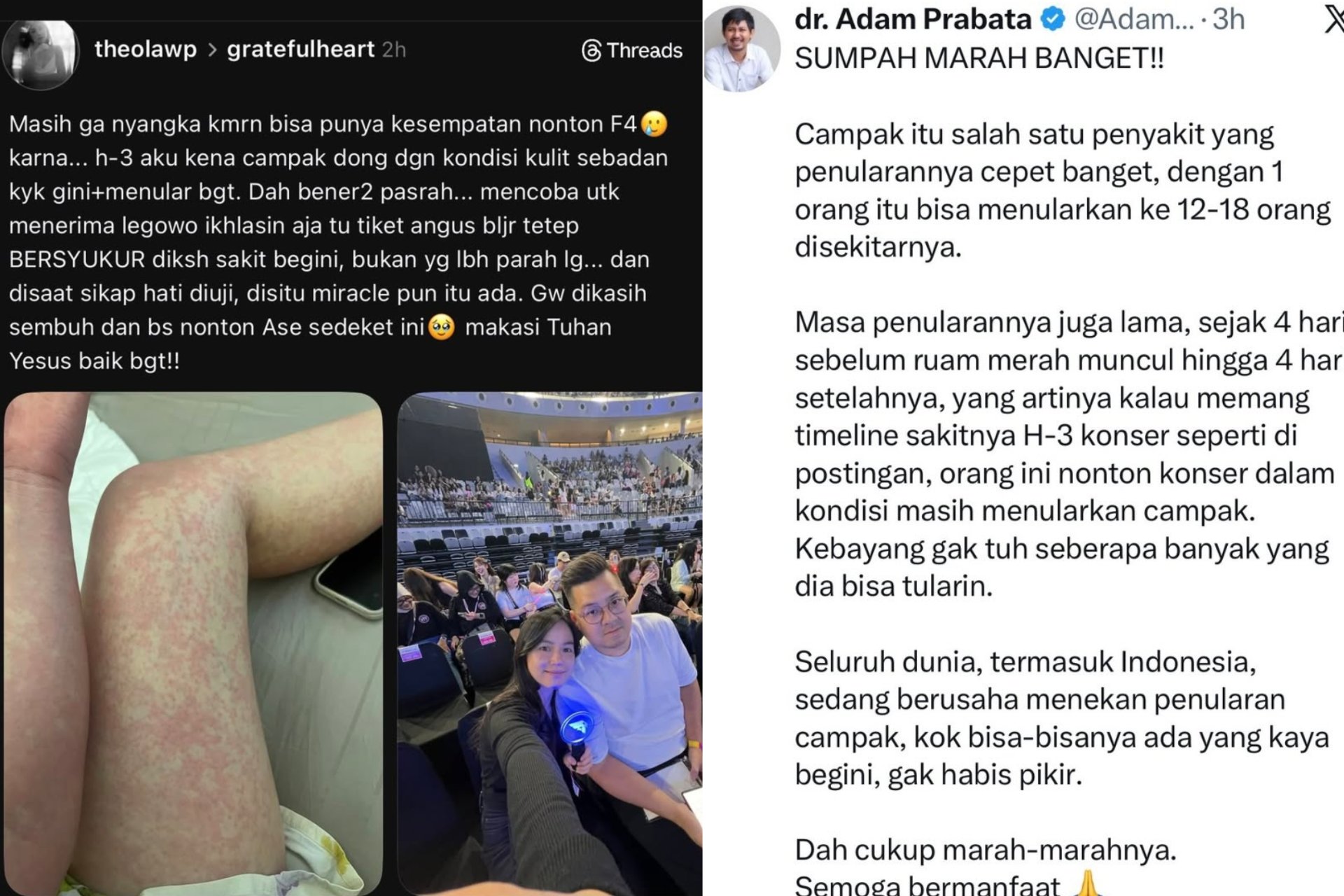 Heboh! Kena Campak Tetap Nekat Nonton Konser F4, Netizen Ngamuk: Egois, Bisa Nularin Satu Stadion