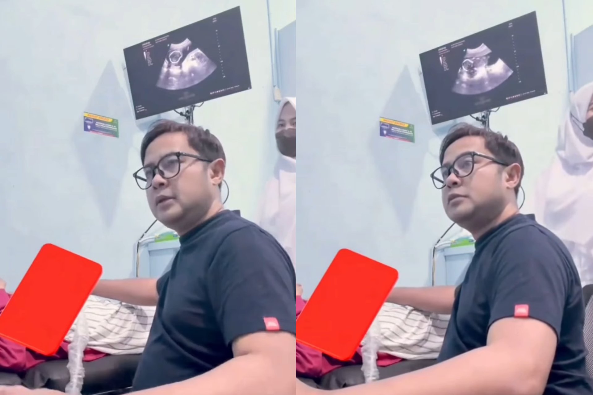 Momen Haru Ibu Hamil Periksa USG, Justru Terima Kabar Duka Janin Meninggal Dunia