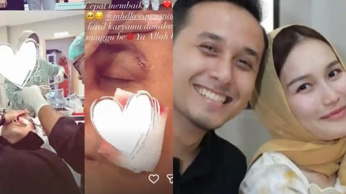 Kencan Romantis Ayu Ting Ting Justru Berujung di Rumah Sakit, Kevin Gusnadi Alami Luka di Wajah