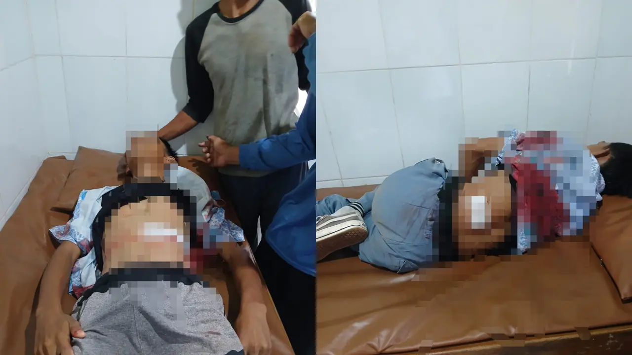 Pelajar SMA Duel Lawan Begal Bersenjata di Lampung, Ditembak hingga Peluru Tembus Perut
