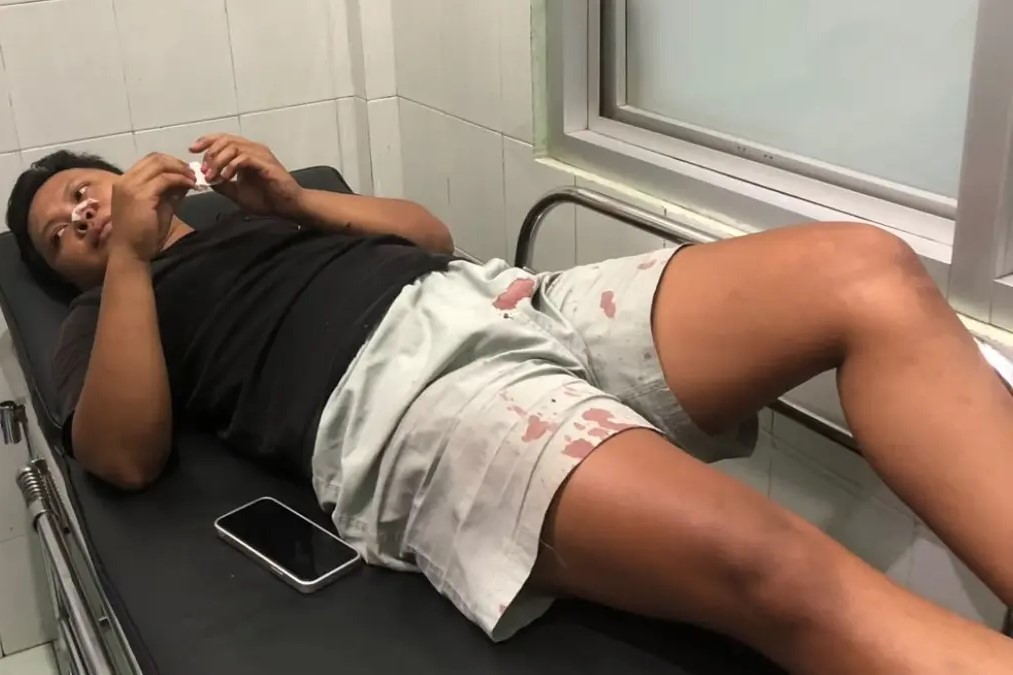 Geger di Boyolali! Sedang Tiduran Santai, Tukang Tambal Ban Mendadak Ditembak OTK 5 Kali