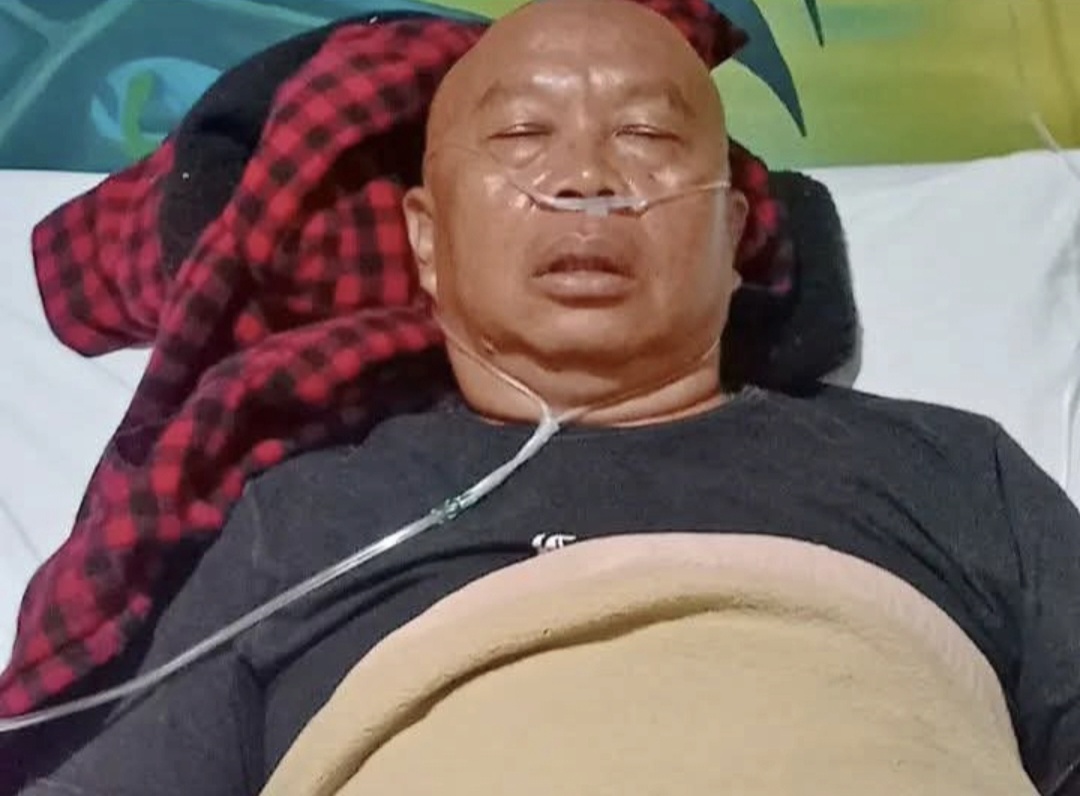 Joe P-Project Alami Kecelakaan Saat Syuting di Bali, Dua Rusuk Kanan Patah